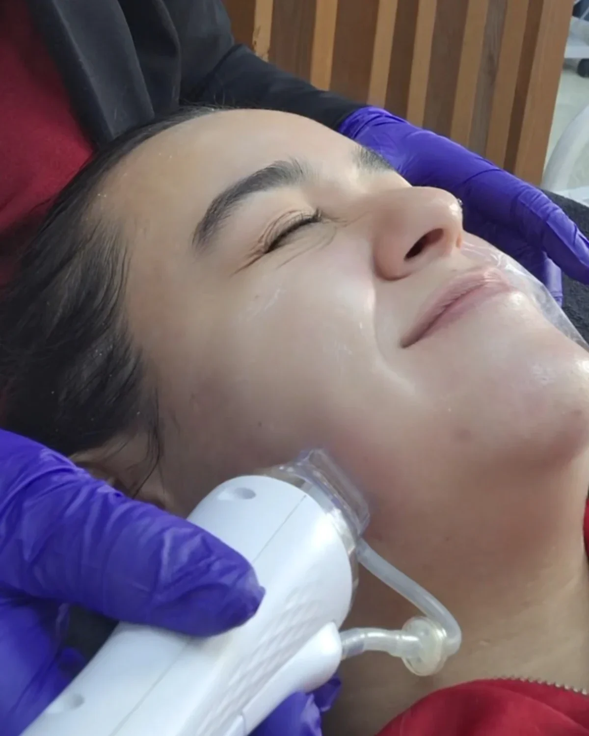 oxigenoterapia